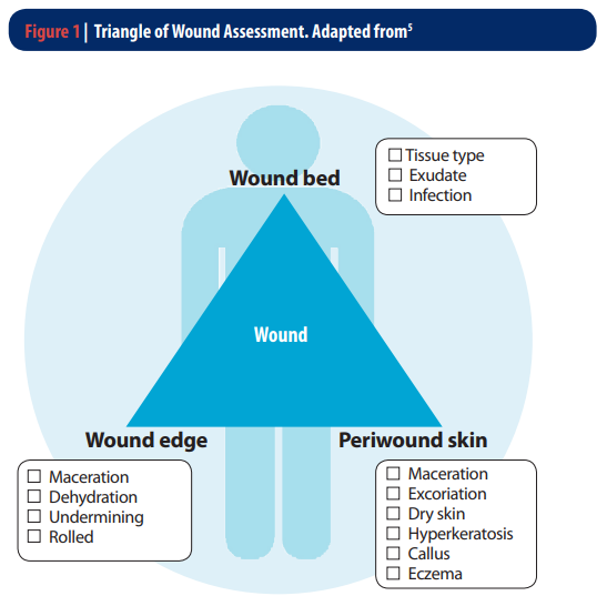 Lower limb triangle of wound assessment Diagram showing the triangle of wound assessment